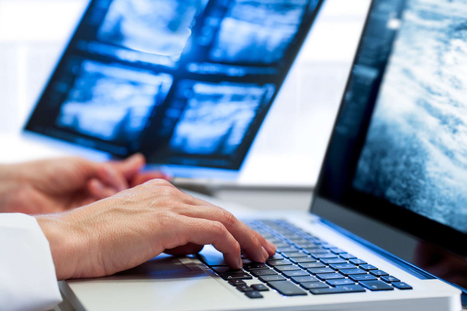 Extreme close up of medical practitioners hand introducing x-ray results on laptop.