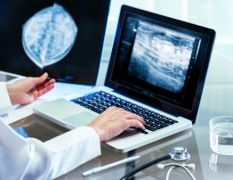 Close up of Doctor reviewing mammography results on x-ray and typing results on laptop.