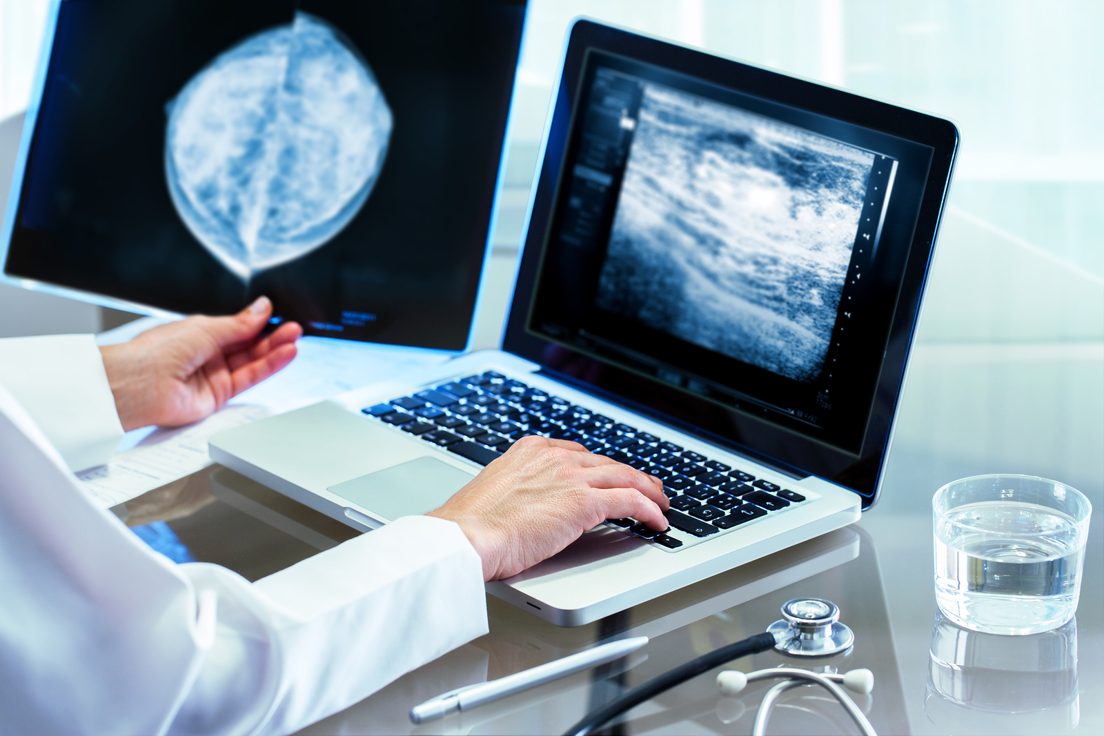 Close up of Doctor reviewing mammography results on x-ray and typing results on laptop.