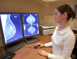 Mammography test