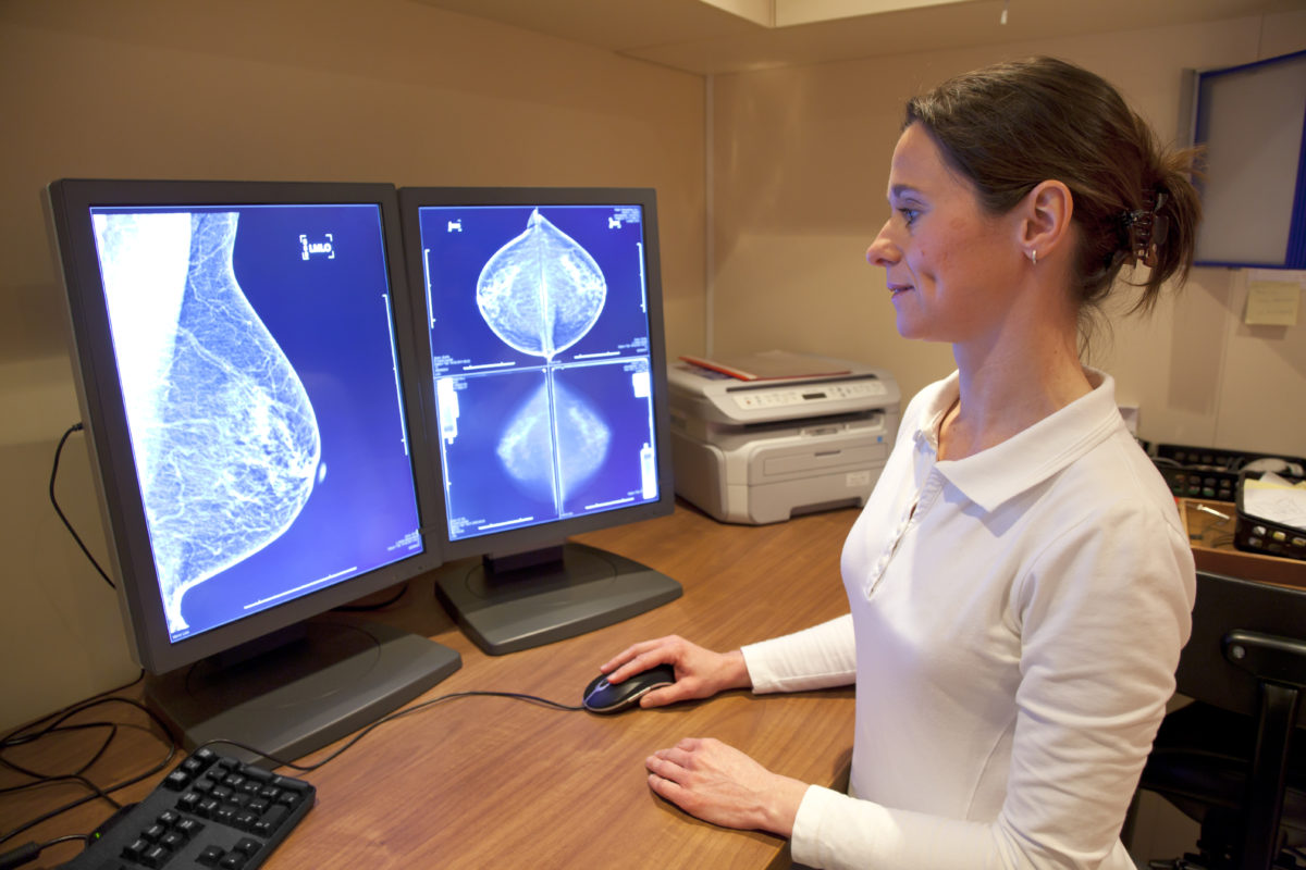 Mammography test