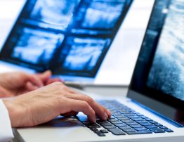 Extreme close up of medical practitioners hand introducing x-ray results on laptop.